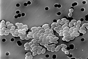 Image of vancomycin-resistant Enterococcus courtesy of CDC/ Janice Haney Carr
