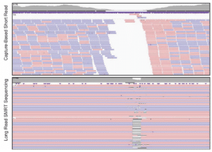 PacBio long reads enable detection and phasing of an allele missed by short-read sequencing - PacBio