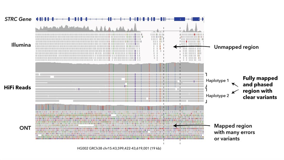 HiFi Sequencing of STRC gene IGV pile-up - PacBio