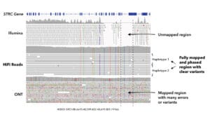 HiFi Sequencing of STRC gene IGV pile up_revised - PacBio