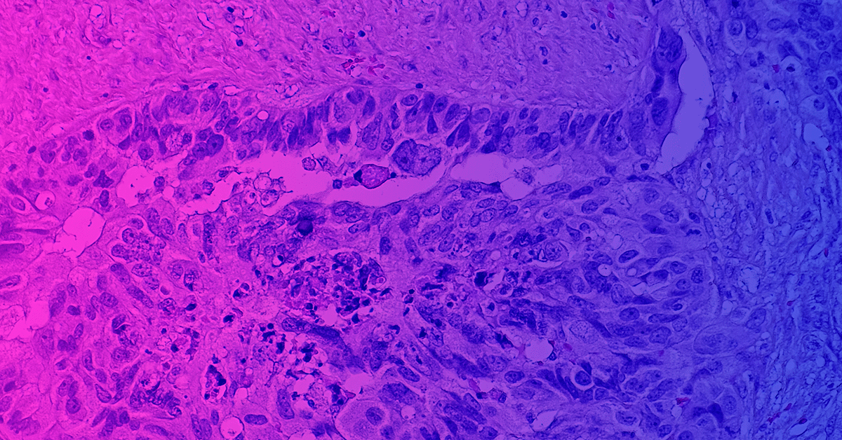 Image of an tumor cross section