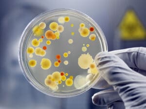 microbiology agar cells colony and culture