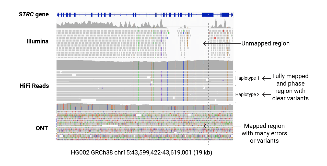 HiFi sequencing of STRC gene