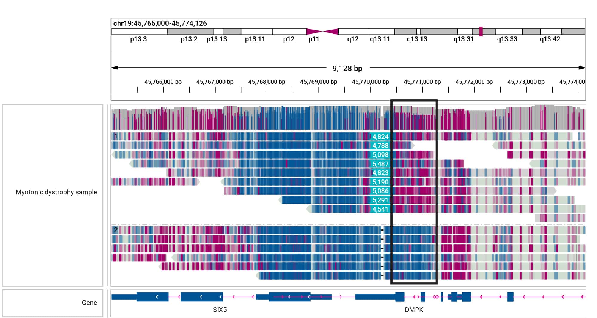 HiFi sequencing phases and identifies hypermethylation of the region adjacent to a mosaic 5 kb DMPK expansion in a sample with myotonic dystrophy (Children’s Mercy Kansas City). Magenta indicates methylation, while blue indicates unmethylated bases.