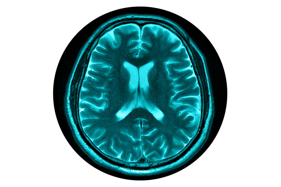 blue illustration of Brain x-ray