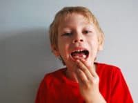 Children's cavities